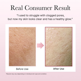 Arencia - Fresh Rosehip Rice Mochi Cleanser